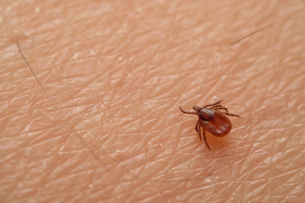Tick,(ixodes,Ricinus),On,Skin.,Dangerous,Mite,,Can,Cause,Lyme
